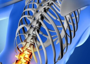 Suffered a Spinal Cord Injury: Your Legal Options Explained