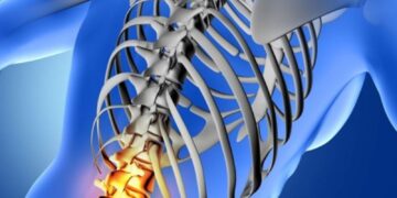 Suffered a Spinal Cord Injury: Your Legal Options Explained