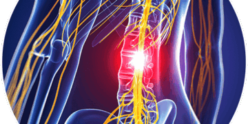 Symptoms of a Herniated Disc and How It Can Lead to Spinal Cord Damage
