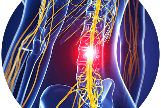 Symptoms of a Herniated Disc and How It Can Lead to Spinal Cord Damage