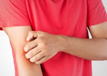 How to Identify and Prevent Ringworm and Eczema?