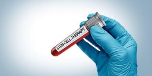 Stem Cell Therapy in Chicago and the Future of Healing