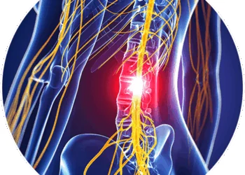 Symptoms of a Herniated Disc and How It Can Lead to Spinal Cord Damage