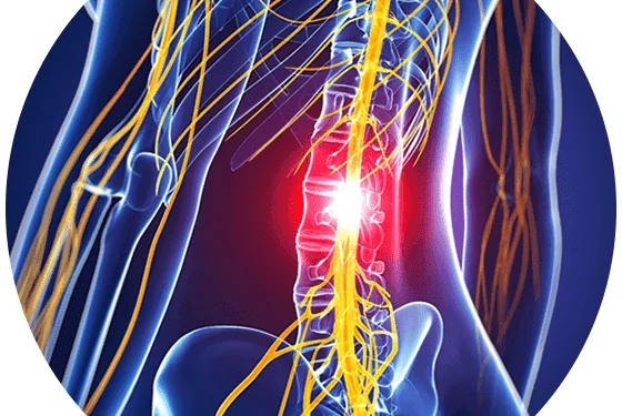Symptoms of a Herniated Disc and How It Can Lead to Spinal Cord Damage