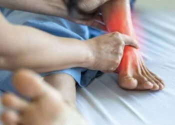 What to Know About IV Infiltration Burns and Tissue Damage