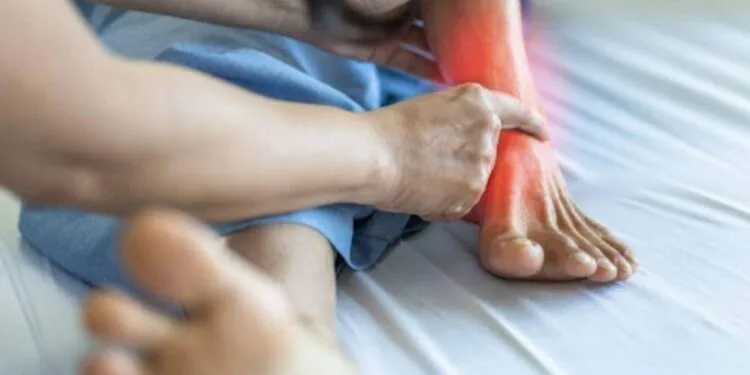 What to Know About IV Infiltration Burns and Tissue Damage